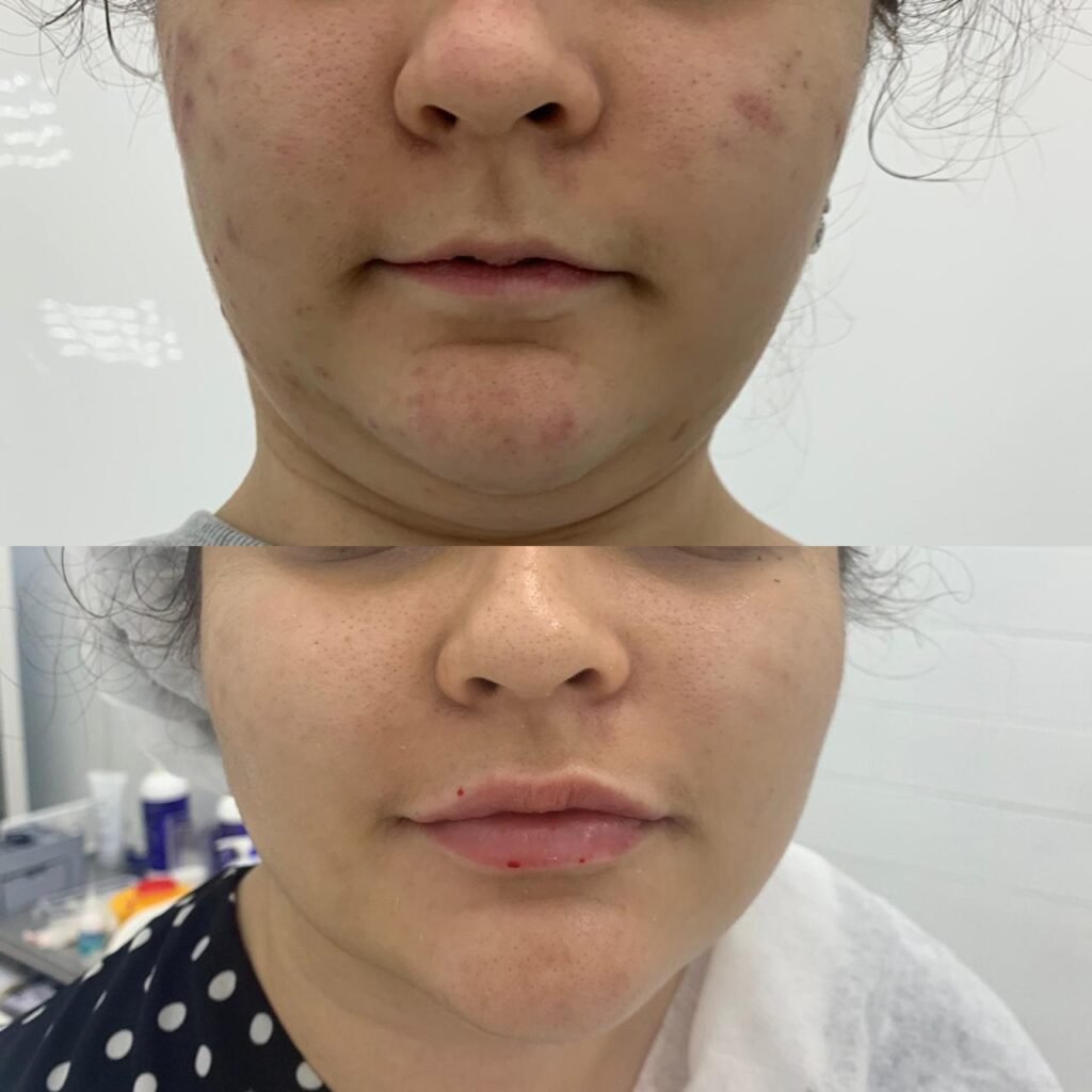 Certified-skincare-specialist-providing-facial-treatment-at-M-Azur
