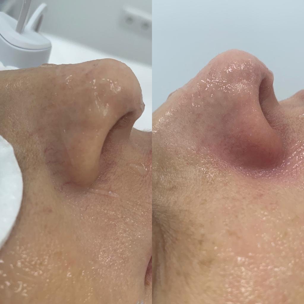 Professional-facial-treatment-at-M-Azur-skincare-clinic