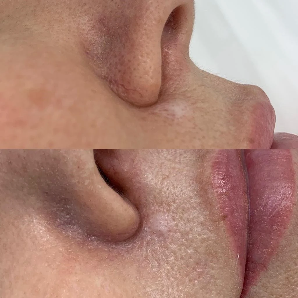Professional-facial-treatment-at-M-Azur-skincare-clinic